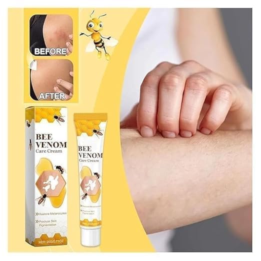 Bee Venom Vitiligo Treatment Herbal Skin Pigment Repair Cream