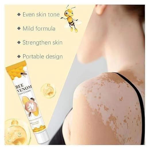 Bee Venom Vitiligo Treatment Herbal Skin Pigment Repair Cream