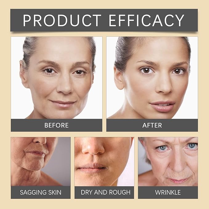 Bee Venom Face Cream Anti-Wrinkle And Anti-Aging Treatment (100g)