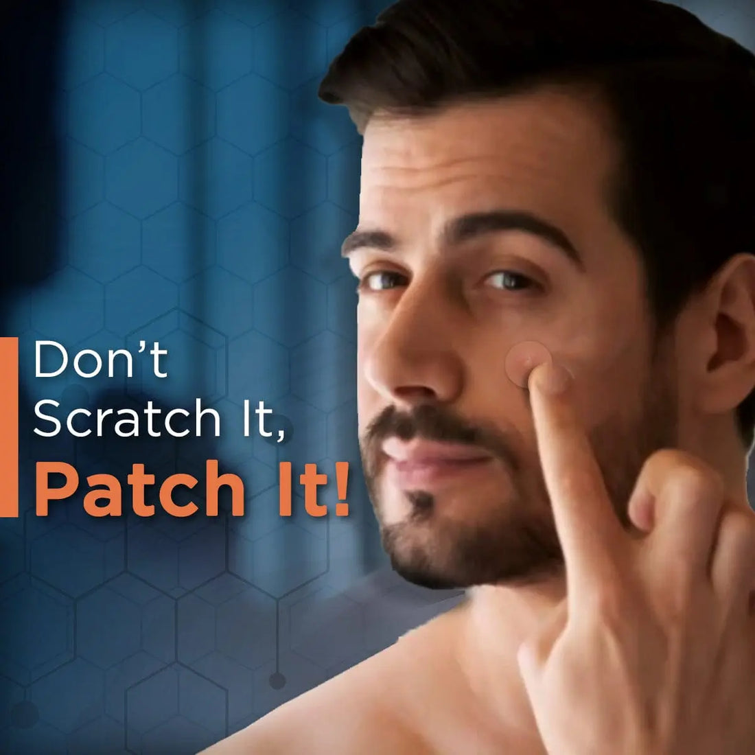 Exopatch™️ - Acne Spot Patch Pack Of 72 Patches Poshure®
