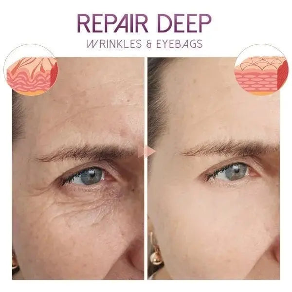Anti ageing and Dark circle serum Poshure®