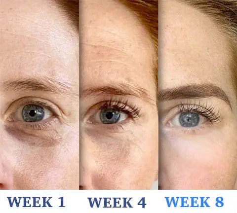 Anti ageing and Dark circle serum Poshure®
