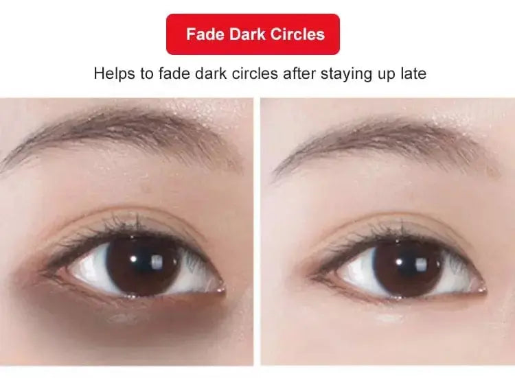 Bye Bye Dark Circle Eye Cream - Natural Herbs Poshure®