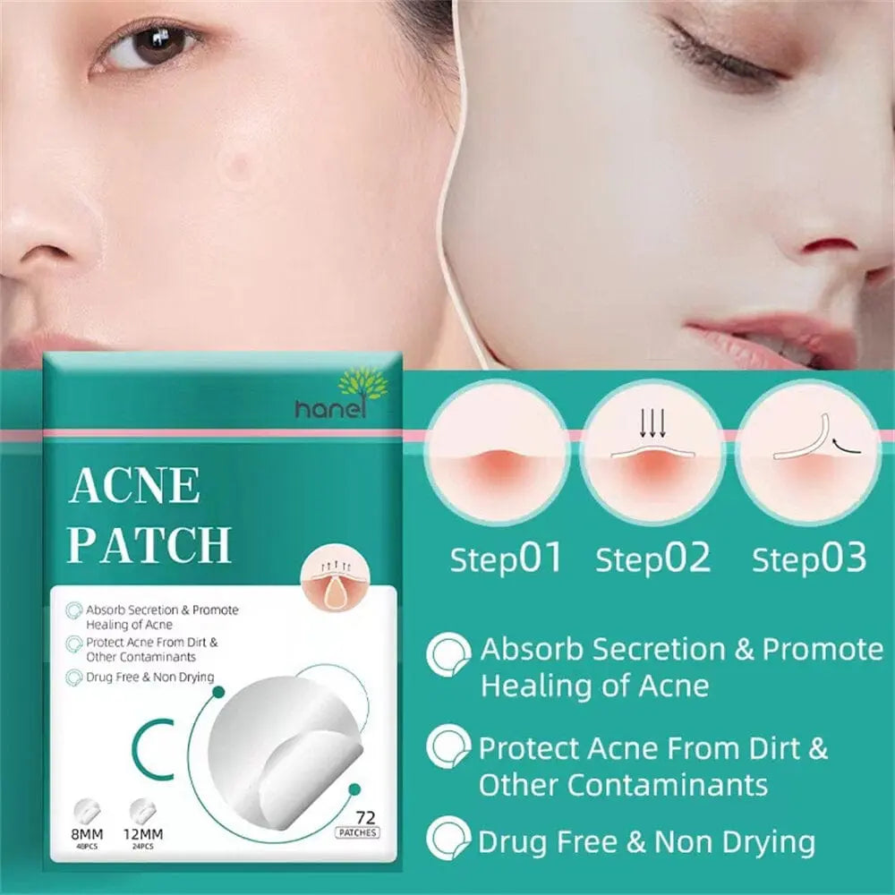 Exopatch™️ - Acne Spot Patch Pack Of 72 Patches Poshure®