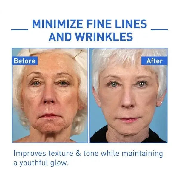 Elixiris™️ Antiage Anti Wrinkle Face Serum Solution Poshure®