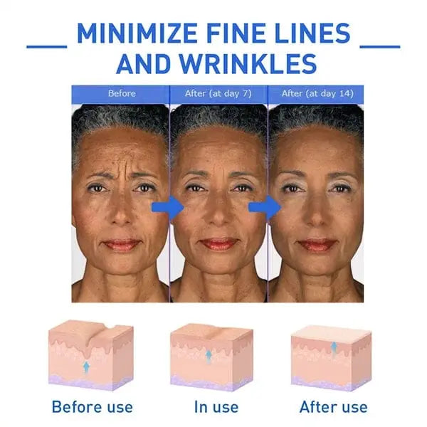 Elixiris™️ Antiage Anti Wrinkle Face Serum Solution Poshure®