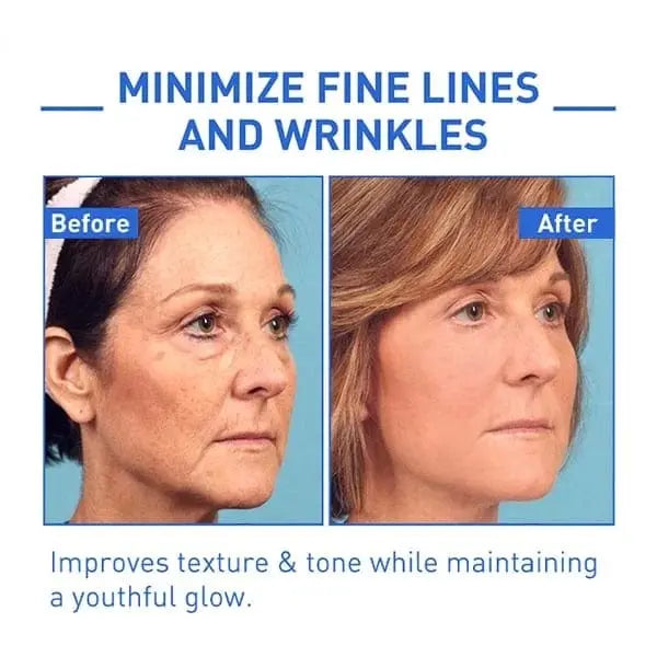 Elixiris™️ Antiage Anti Wrinkle Face Serum Solution Poshure®