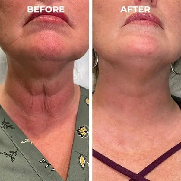 Elixiris™️ Antiage Anti Wrinkle Face Serum Solution Poshure®