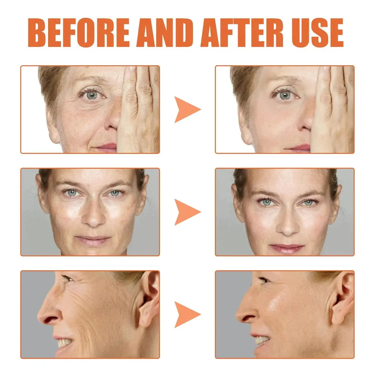 Elixiris™️ Antiage Anti Wrinkle Face Serum Solution Poshure®