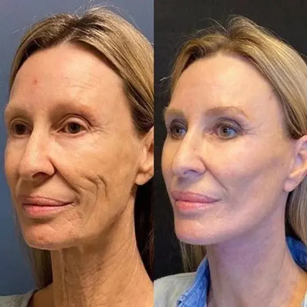 Elixiris™️ Antiage Anti Wrinkle Face Serum Solution Poshure®
